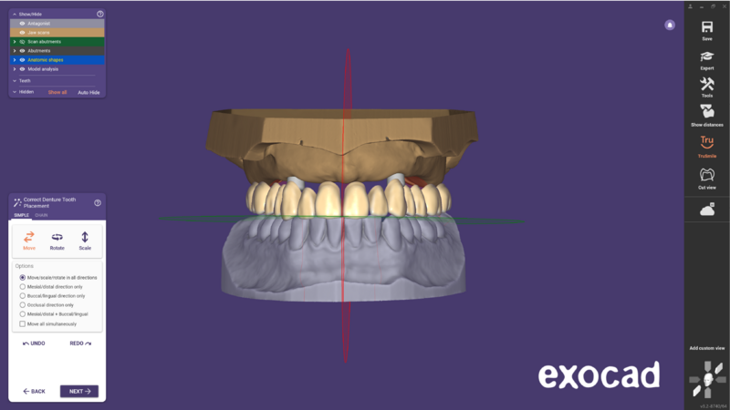 File:Ball attachment-05.png