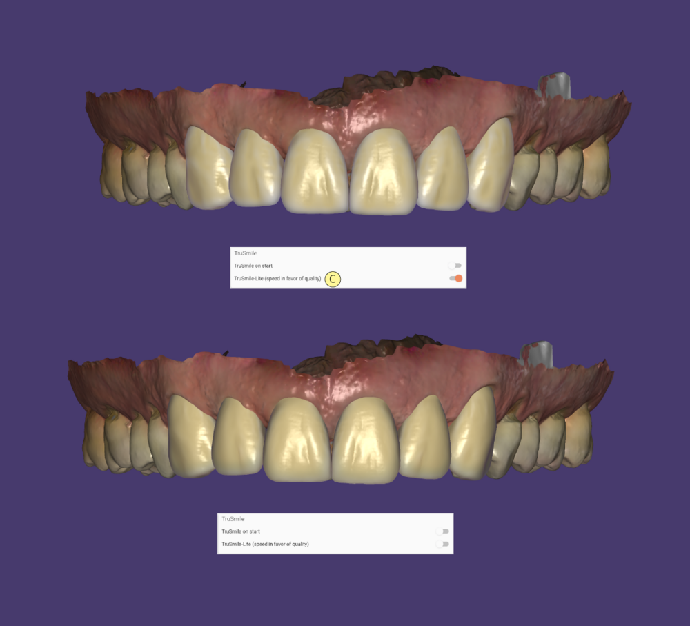 TruSmile-10.png