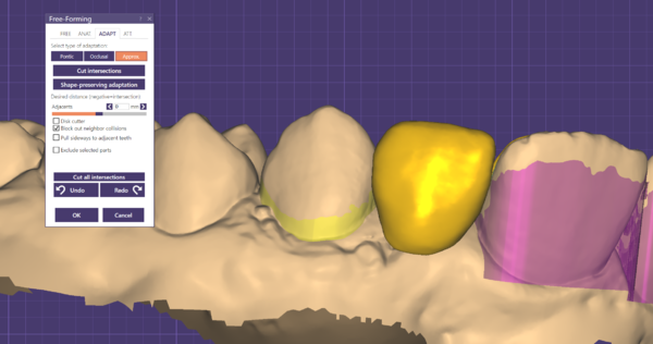 Exocad-support-192-2.png