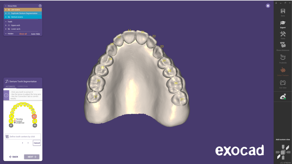 Duplicate denture-09.png