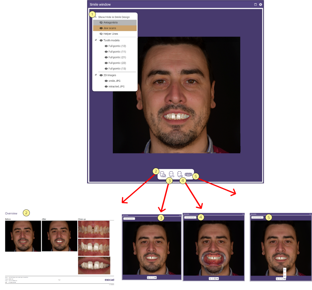 Smile window 4.png