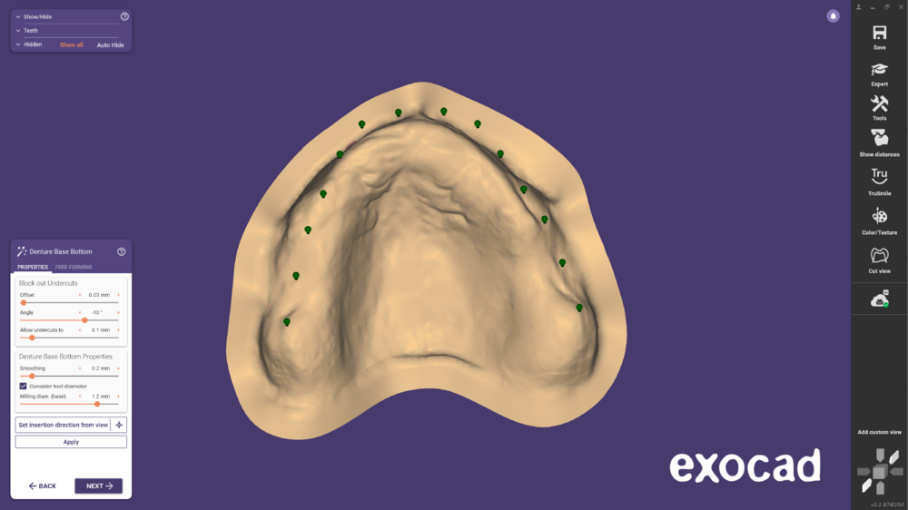 Duplicate denture -01.png