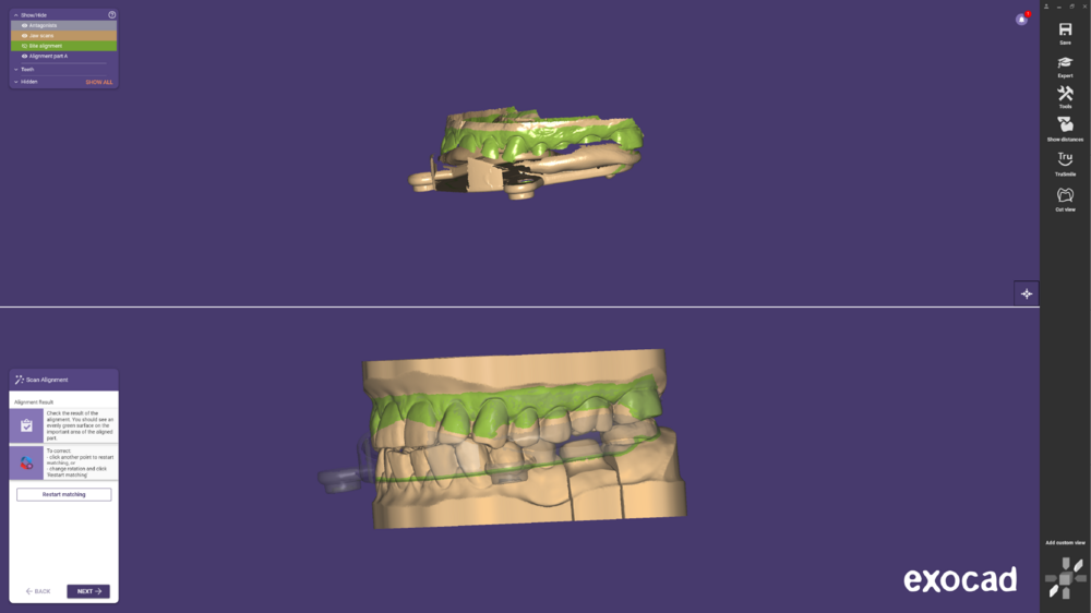 Jaw movement-01.png
