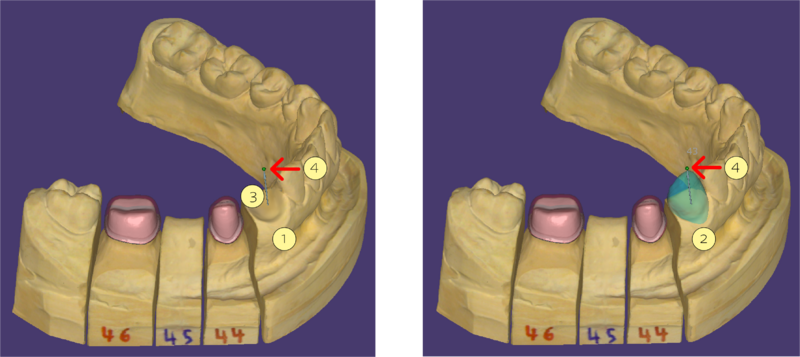File:Extract tooth Select 1.png