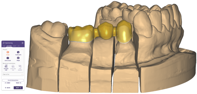 File:Wax up 2.png