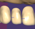 Thumbnail for version as of 11:38, 26 June 2020