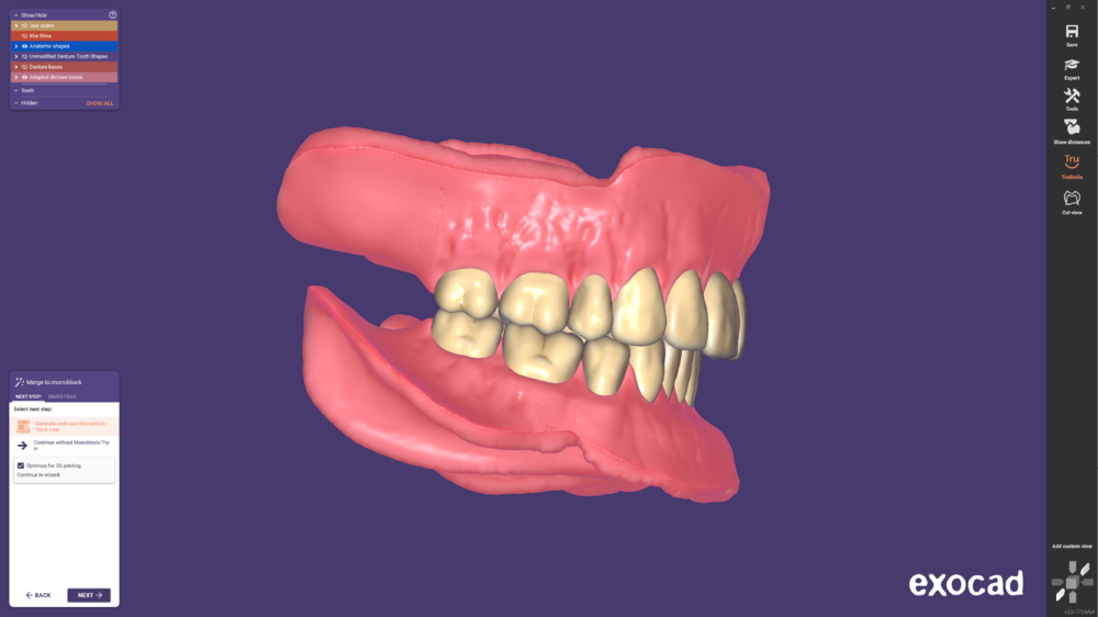 Denture remove teeth4-10.png
