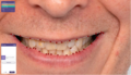 Thumbnail for version as of 10:17, 15 June 2021
