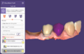 Thumbnail for version as of 11:13, 24 November 2022