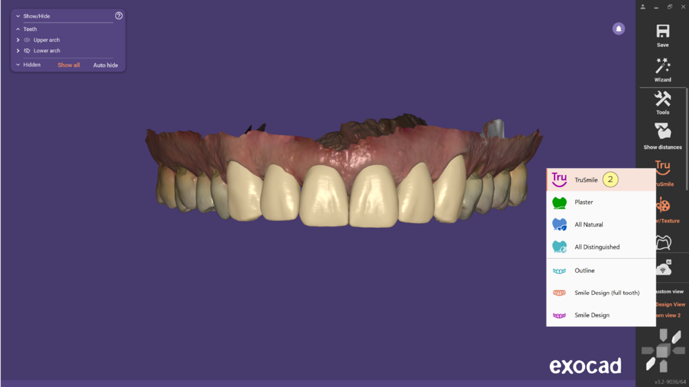 TruSmile-03.png