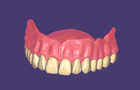 Adapting denture base to teeth