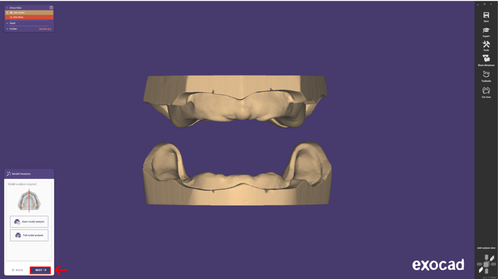 Denture remove teeth4-01.png