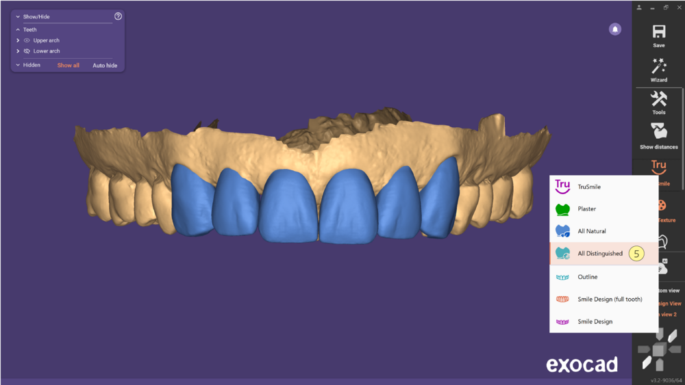 TruSmile-06.png