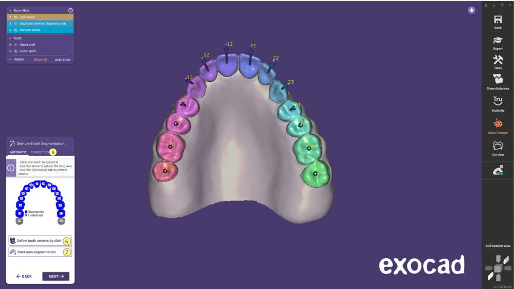 Duplicate denture-10.png