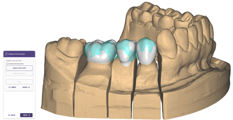 File:Pre-op4.png