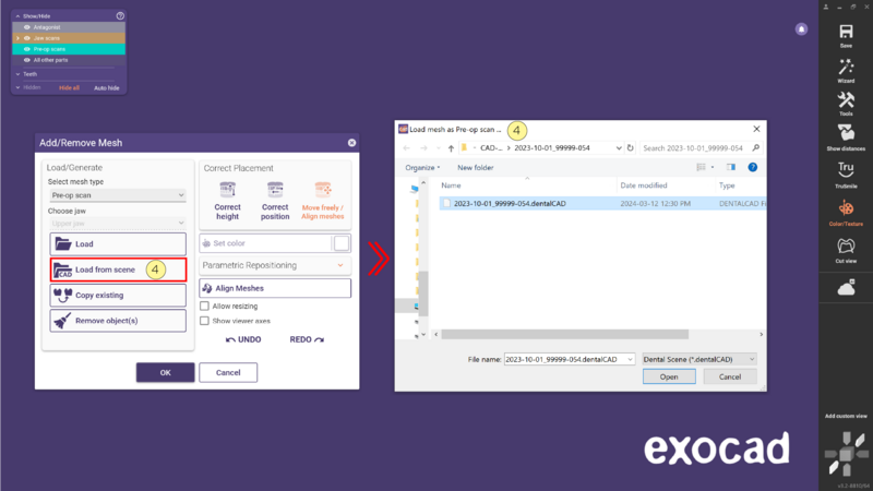 File:Add remove 3 3.2.png