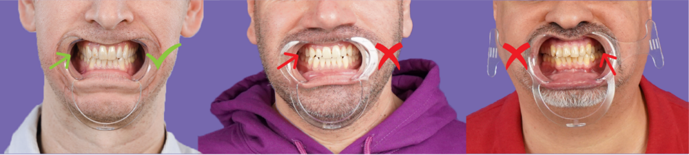 Smile creator bc2.png