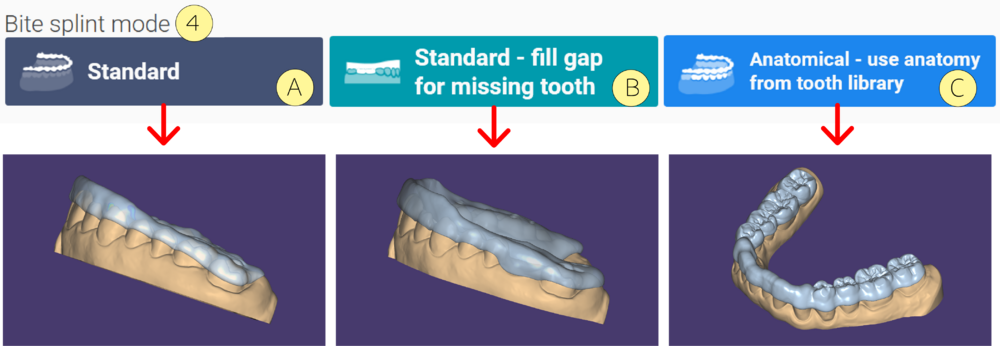 Bite splint 4 3.1.png