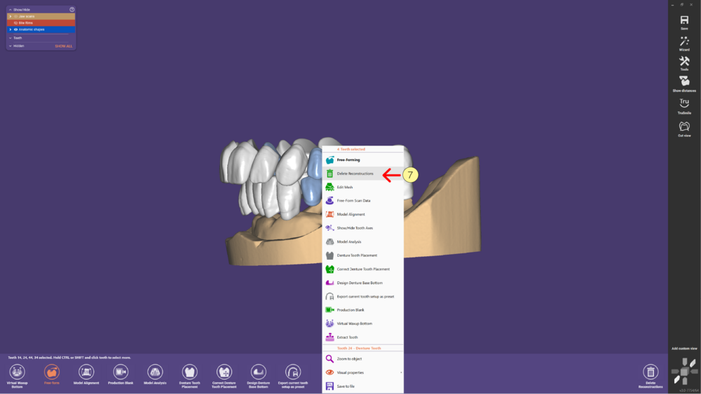 Denture remove teeth4-05.png