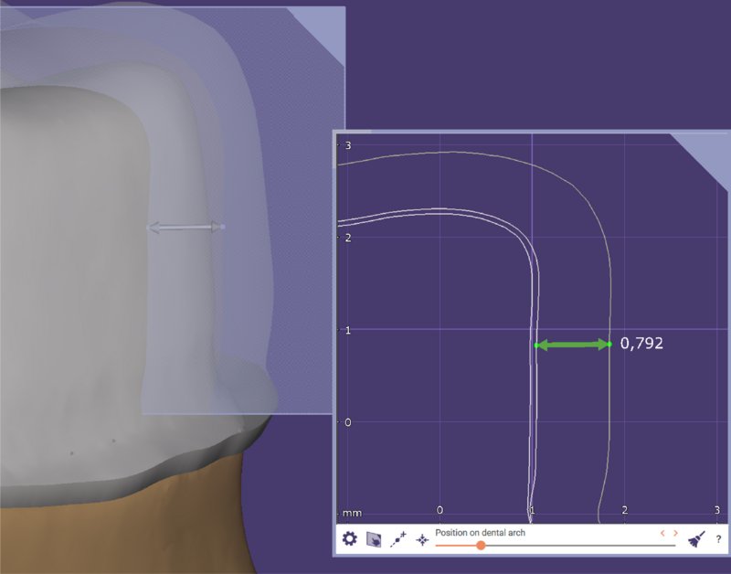 Measurement tool galway.png