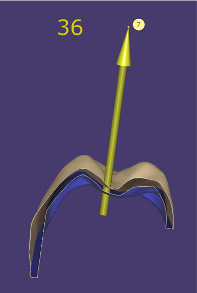 Provisonal crown bottom drag.png
