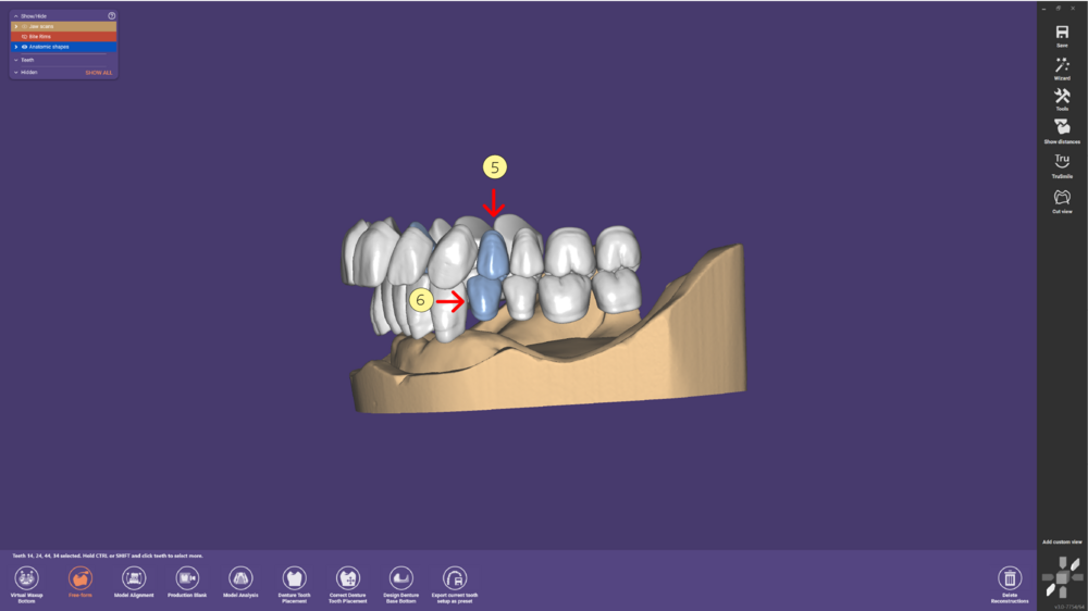 Denture remove teeth4-04.png