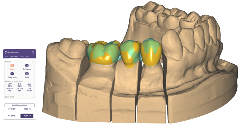 File:Pre-op3.png
